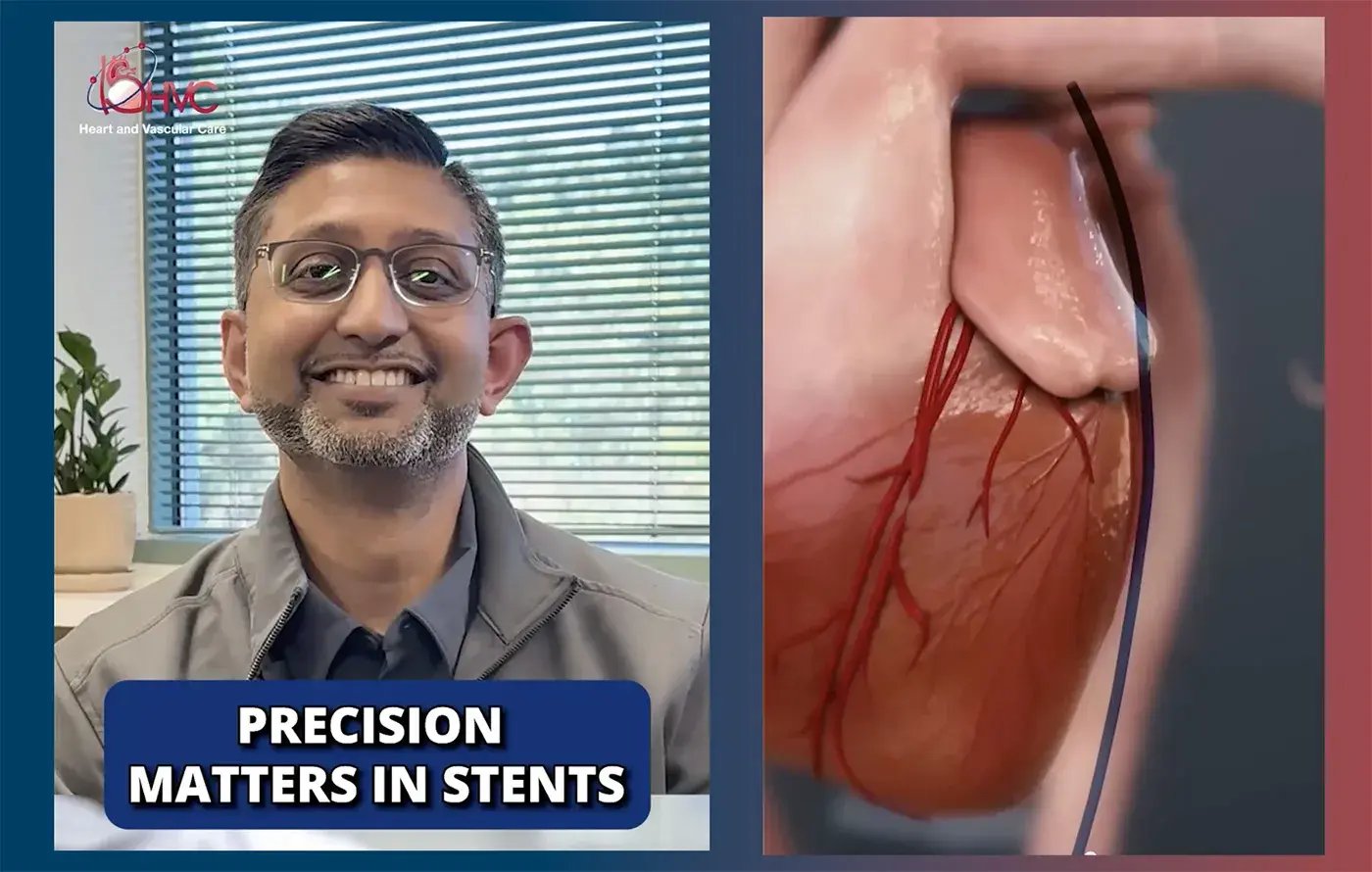 stent-precision-matters-thumbnail