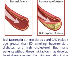 coronary artery (1)